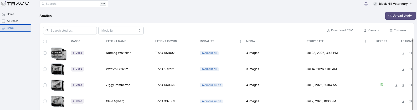 A screenshot of Travv's PACS radiology software interface